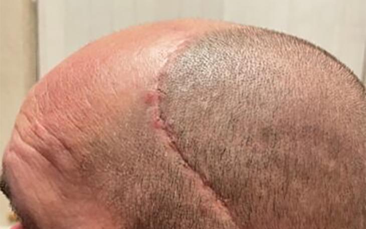 Steven Tyson injured when wall collapsed on him