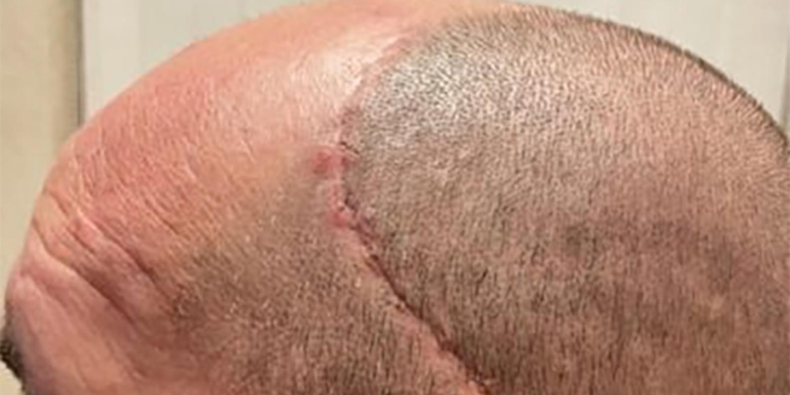 Steven Tyson injured when wall collapsed on him